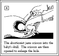abortion facts